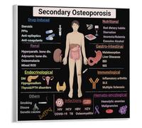 Bone Health & Osteoporosis Chart - Factors & Prevention Guide, Educational Wall Art for Clinic or Home Office(Unframed,16x24inch(40x60cm))