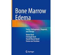 Bone Marrow Edema: Forms, Pathogenesis, Diagnosis, and Therapy
