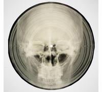 Bone Music: Soviet X-Ray Audio