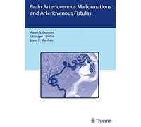 Malformaciones y fístulas arteriovenosas cerebrales – Thieme