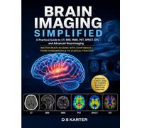 BRAIN IMAGING SIMPLIFIED Vol - ONE: A Practical Guide to Brain CT, MRI, Emergency Neuroimaging, Stroke Imaging, Tumor Imaging, and Advanced Neuroimaging (The Doctor's Clinical Library)