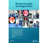 Broncoscopia de diagnóstico