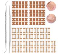 BUTBU Juego de Uñas Encarnadas, 122 PCS Uego de Correctores de Uñas Encarnadas, 120 Parche Corrector de Uñas, Juego de Cortauñas Profesionales para Uñas Encarnadas