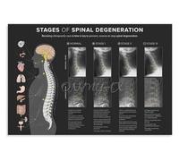 BYLSAGWHT Educational Spine Anatomy Poster Detailed Human Backbone Chart Scientific Art Canvas Print Wall Decor for Office Study Room Library (8 X 12 in)