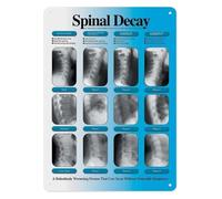 BYLSAGWHT Spine Anatomy Chart Metal Tin Sign Human Backbone Vertebrae Discs Diagram Educational Wall-Art for Chiropractor Office School Laboratory Decor 8 X 12 Inch