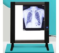 Caja de tablero LED de rayos X, iluminador de visor de diapositivas con lector de películas profesional, panel acrílico y marco de aluminio, brillo ajustable de 0-100%, sin sombras(Single couplet)