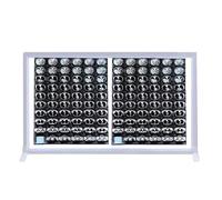 Caja Luz Iluminadora PelíCula Rayos X Panel Luz Visor De Rayos X Para Hospital Panel AcríLico + Marco AleacióN Aluminio 1,8 Cm Espesor Adecuado para ClíNicas Y Hospitales 77x51x1.8cm/30.3x20x0.7in