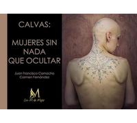 Calvas: mujeres sin nada que ocultar