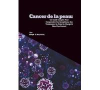 Cancer de la peau: Un Guide Complet Pour Comprendre Ses Symptômes, Son Traitement, Sa Prise En Charge Et Bien Plus Encore!