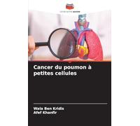 Cancer du poumon à petites cellules