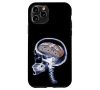 Carcasa para iPhone 11 Pro Divertido Amante del Pan De Masa Madre Xray Cerebro Hornear Meme