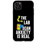 Carcasa para iPhone 11 Pro MAX Film Photography The Lab Scan Anxiety Is Real Analog