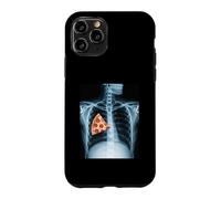 Carcasa para iPhone 11 Pro Rib Cage X-Ray Pizza Slice Funny Food Humor Anatomía