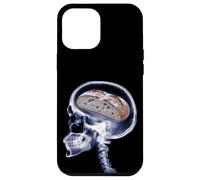 Carcasa para iPhone 12 Pro MAX Divertido Amante del Pan De Masa Madre Xray Cerebro Hornear Meme