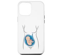 Carcasa para iPhone 12 Pro MAX Embarazo Anatomía Feto En Utero OBGYN Partera
