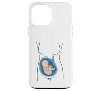 Carcasa para iPhone 13 Pro MAX Embarazo Anatomía Feto En Utero OBGYN Partera
