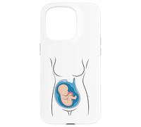 Carcasa para iPhone 15 Pro Embarazo Anatomía Feto En Utero OBGYN Partera