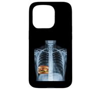 Carcasa para iPhone 15 Pro Rib Cage X-Ray Cheeseburger Comida Divertida Humor Anatomía