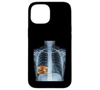 Carcasa para iPhone 15 Rib Cage X-Ray Cheeseburger Comida Divertida Humor Anatomía