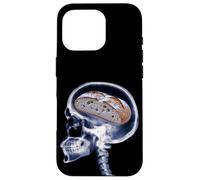 Carcasa para iPhone 16 Pro Divertido Amante del Pan De Masa Madre Xray Cerebro Hornear Meme