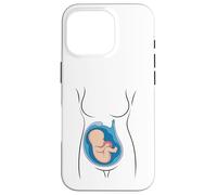 Carcasa para iPhone 16 Pro Embarazo Anatomía Feto En Utero OBGYN Partera