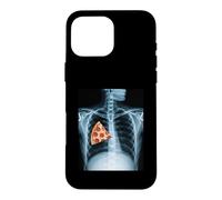 Carcasa para iPhone 16 Pro MAX Rib Cage X-Ray Pizza Slice Funny Food Humor Anatomía