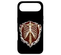 Carcasa para iPhone Air Fie Cómo me duelen los Huesos Enfermera Romeo Julieta Cita Humor