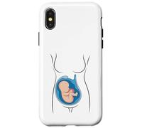 Carcasa para iPhone X/XS Embarazo Anatomía Feto En Utero OBGYN Partera