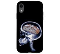 Carcasa para iPhone XR Divertido Amante del Pan De Masa Madre Xray Cerebro Hornear Meme