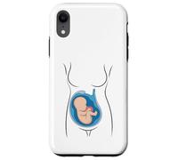 Carcasa para iPhone XR Embarazo Anatomía Feto En Utero OBGYN Partera