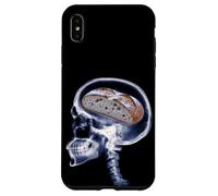 Carcasa para iPhone XS MAX Divertido Amante del Pan De Masa Madre Xray Cerebro Hornear Meme