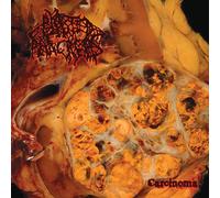 Carcinoma (Vinyl) (Importación USA)