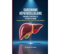 CARCINOME HÉPATOCELLULAIRE PREMIERS SYMPTÔMES ET FACTEURS DE RISQUE: Comment détecter, prévenir et gérer le cancer du foie à temps
