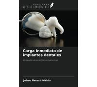 Carga inmediata de implantes dentales: Un desafío al protocolo convencional
