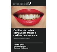 Carillas de resina compuesta frente a carillas de cerámica: Restauración estética anterior