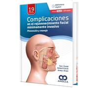 CARNIOL COMPLICACIONES EN EL REJUVENECIMIENTO FACIAL MINIM