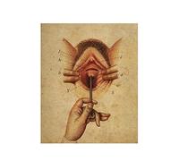 Cartel de anatomía genitales femeninos, cirugía del sistema reproductivo impresión ginecología arte ilustración médica decoración la clínica(1,50x70cm Canvas)