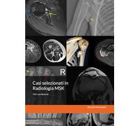Casi selezionati in Radiologia MSK: Content Driven Learning