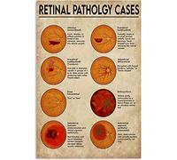 Casos de patología retiniana Letreros de metal Decoración de pared Oftalmología Infografía Pósters Oftalmólogo Placa de oficina Vintage Letrero Decoración Dolor de espalda baja Hogar Habitación Hospit