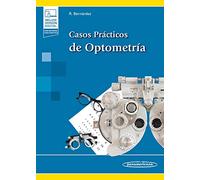 Casos Practicos De Optometria