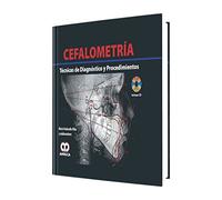 CEFALOMETRIA. TECNICAS DE DIAGNOSTICO Y PROCEDIMIENTOS CD