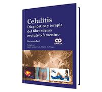 CELULITIS. DIAGNOSTICO Y TERAPIA DEL FIBROEDEMA EVOLUTIVO FEMENINO