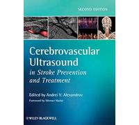 Cerebrovascular Ultrasound in Stroke Prevention and Treatment