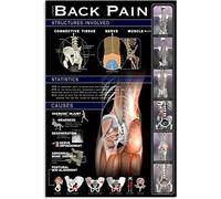Chapa de Metal Guía de infografías sobre las estructuras de conocimiento involucradas en el dolor lumbar Cartel Disuasorio Vintage Placa metálica para Bar Cafetería Cocina S