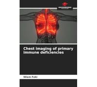Chest imaging of primary immune deficiencies