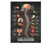 Chiropractic Anatomy Poster Subluxation Effects Patient Education