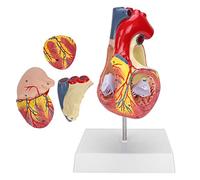 Chiyyak Modelo de Simulación de órgano Cardíaco con Pared Ventricular Desmontable para Educación Médica 6,7 X 5,1 X 11,0 Pulgadas