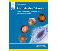 Cirugía de Catarata. Casos complejos y guía práctica para su resolución + ebook