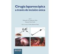 Cirugía laparoscópica a través de incisión única (Medicina y Ciencias de la Salud)