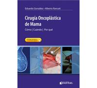 CIRUGIA ONCOPLASTICA DE MAMA COMO CUANDO POR QUE